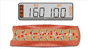 图解血管堵塞全过程，三氧疗法保持血管“年轻态”！