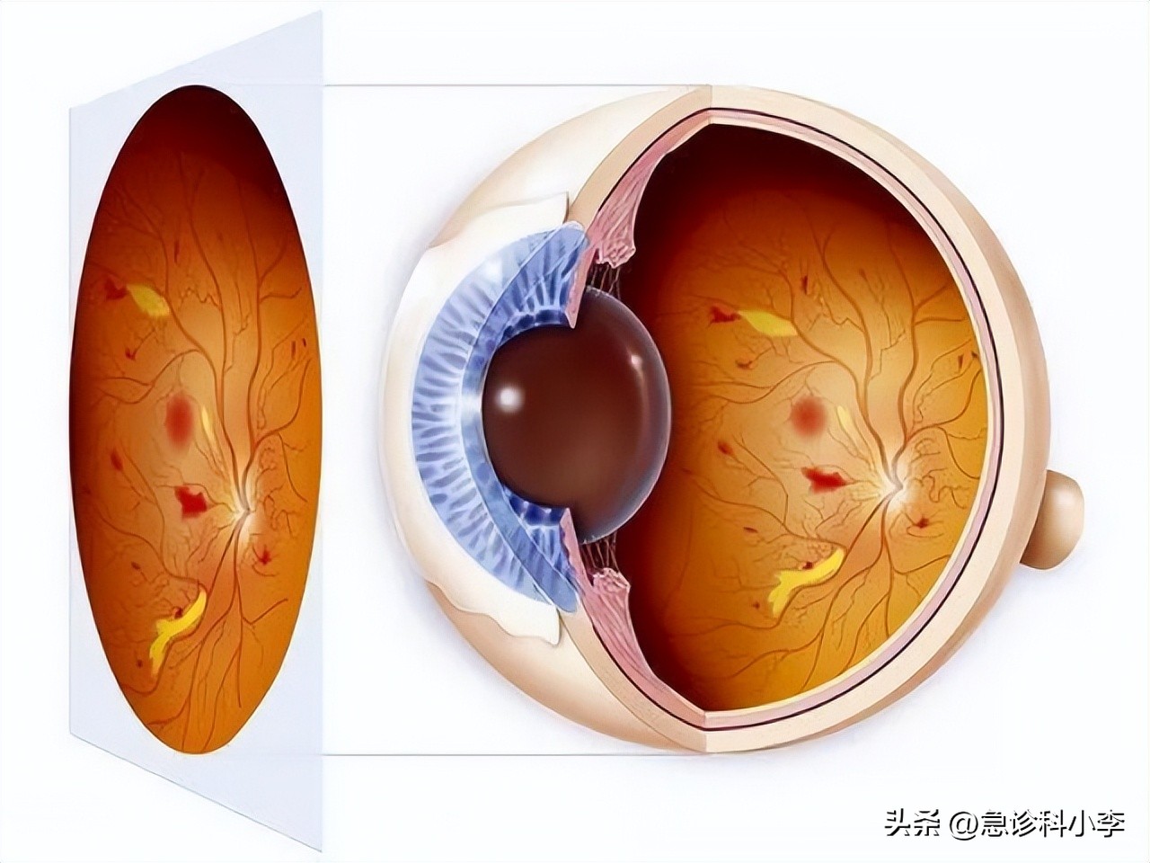 甲钴胺可以修复脑部神经受损吗,大脑中枢神经受损吃甲钴胺可以吗