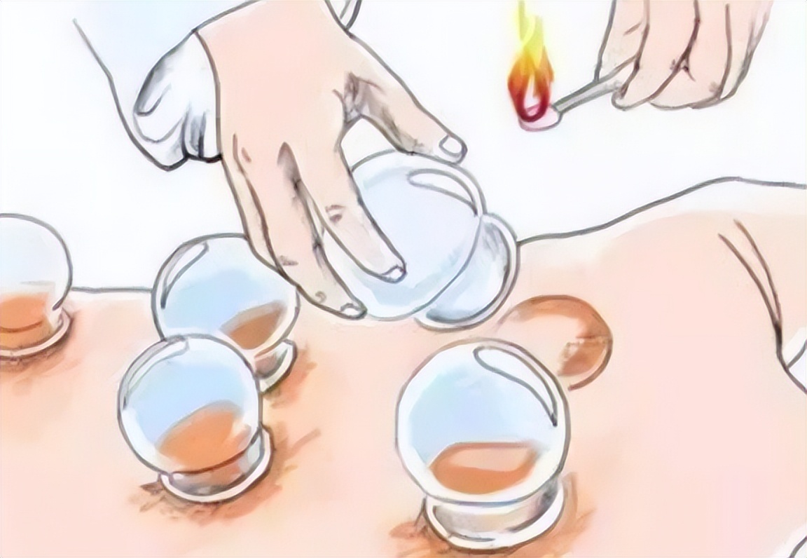 慢性麻疹有治疗好的吗,慢性荨麻疹反复怎么治才能去根