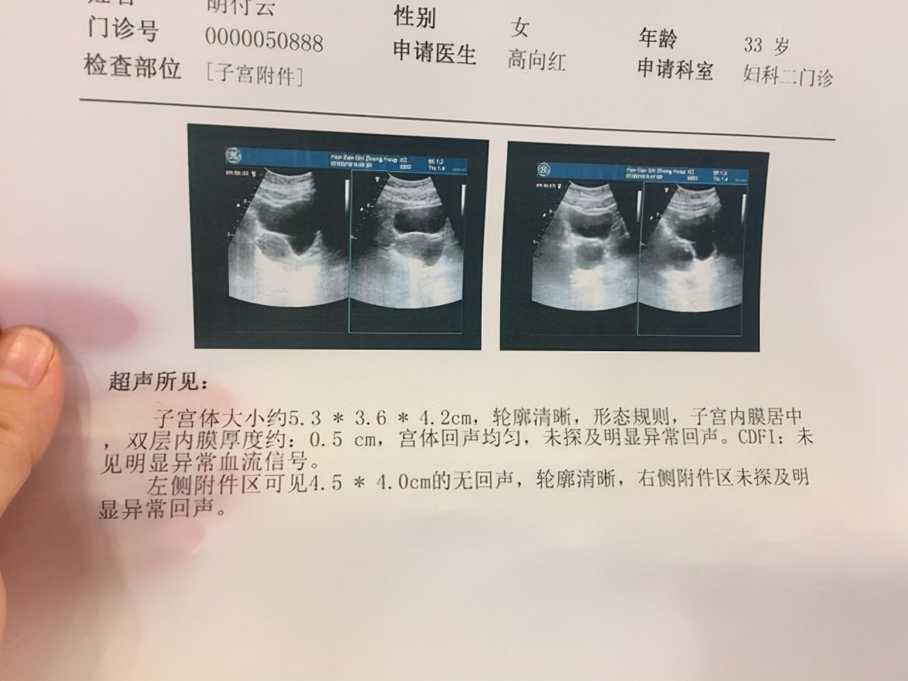 很多囊肿怎么办,发现囊肿需要注意什么