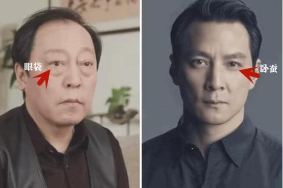 怎样区分卧蚕和眼袋最简单的方法,如何区别眼袋和卧蚕