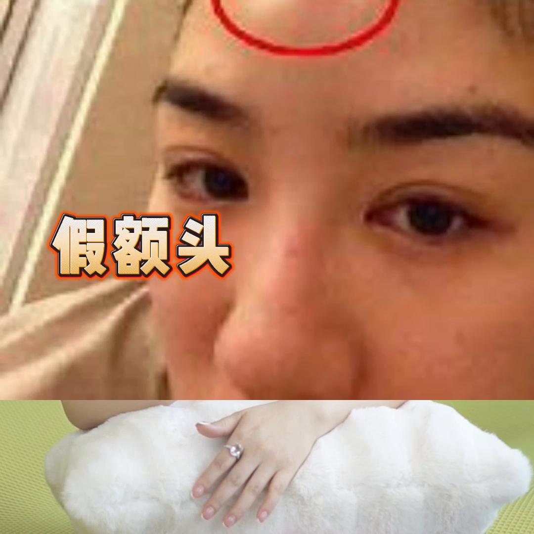 什么样的额头才算好看的额头,什么样的额头才算好看