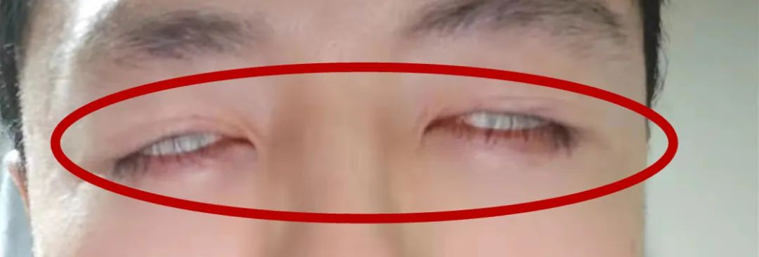 南京施尔美整形医院正规吗,南京施尔美整形整容医院失败案例