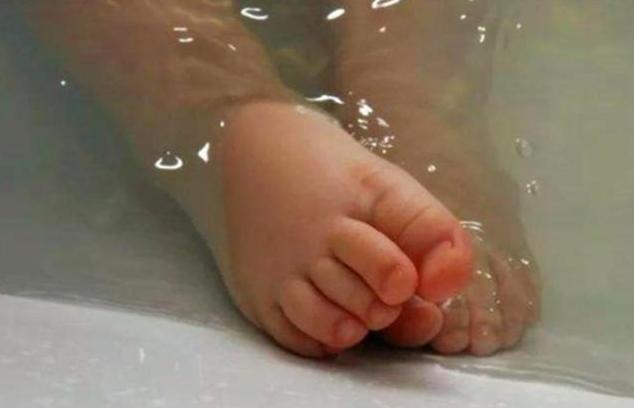 孩子被开水烫伤了该如何紧急处理,小孩被热水烫伤了该怎么处理