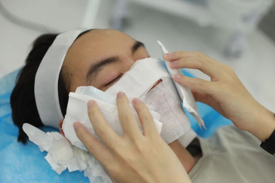 痘坑剥离激光点阵后长痘痘,痘坑点阵激光能彻底去除吗