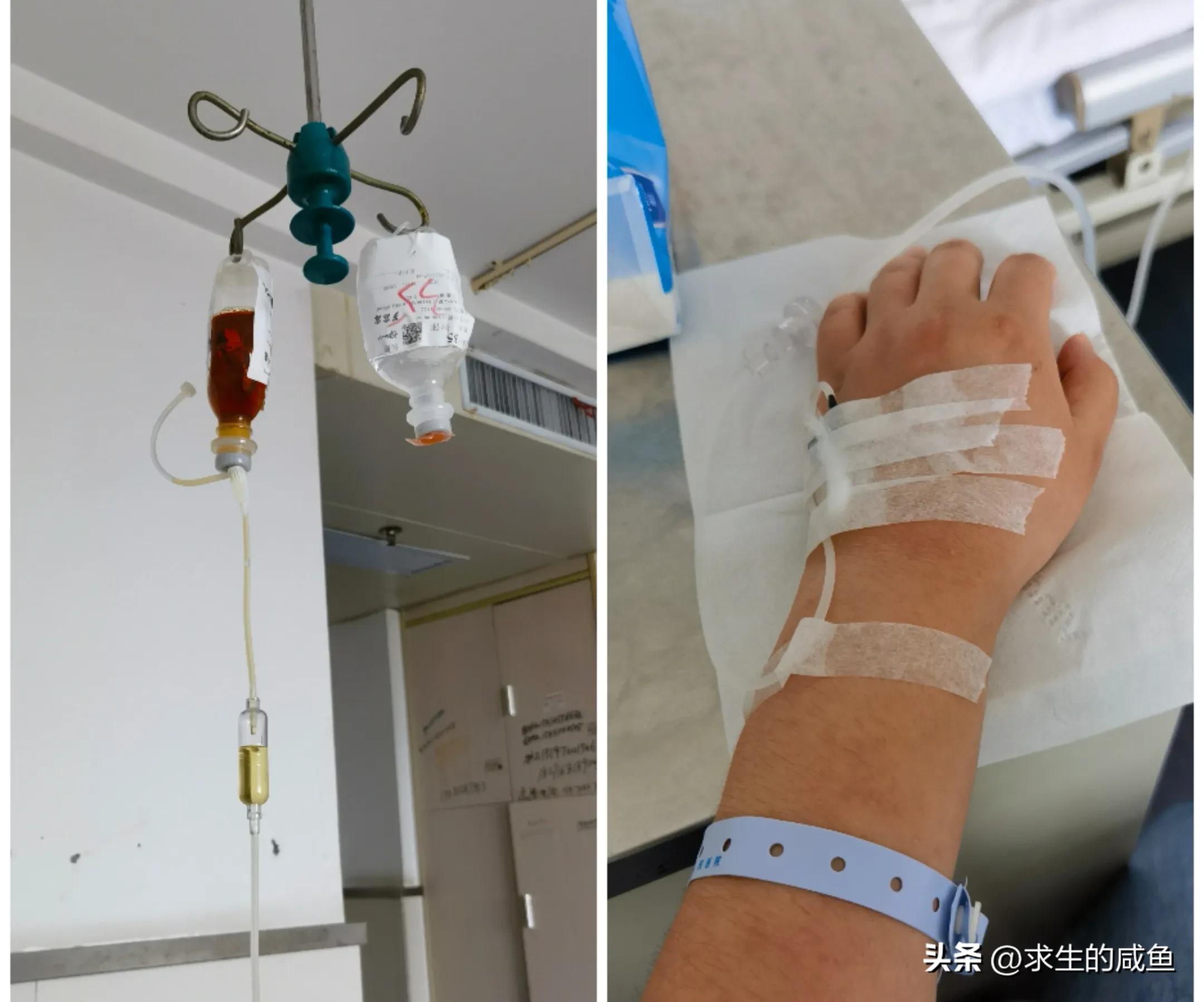 肺部感染住院费一天多少钱,肺部感染住院15天一般多少钱