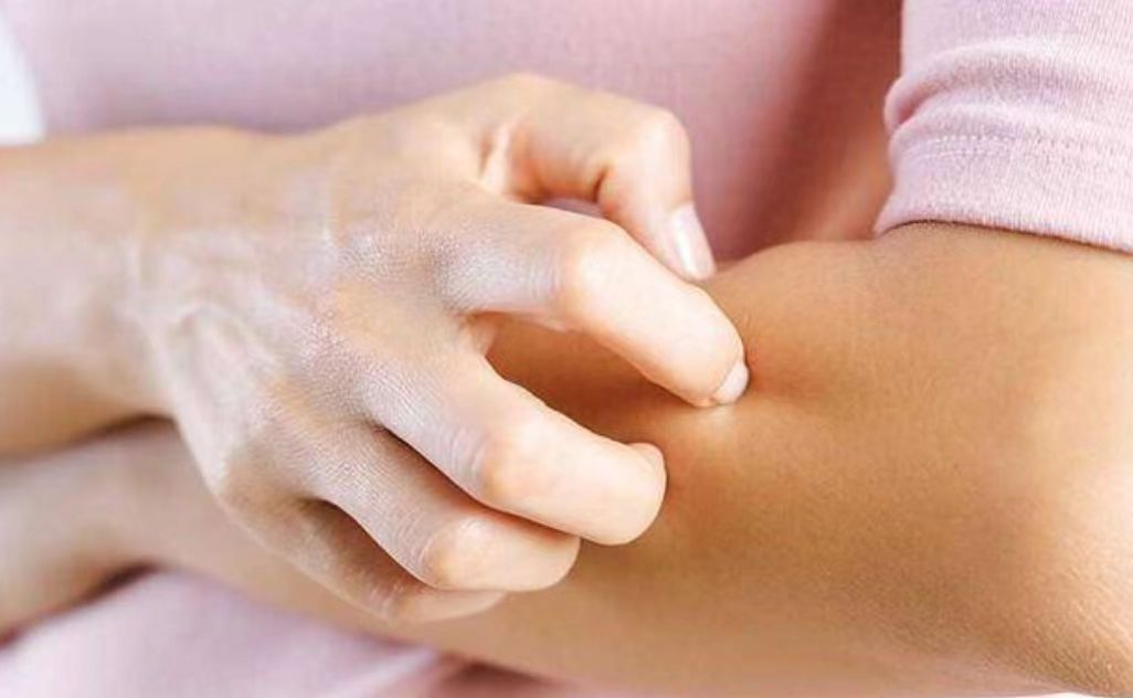 阴虱什么原因会出现在人身上,阴虱的传播途径有哪些