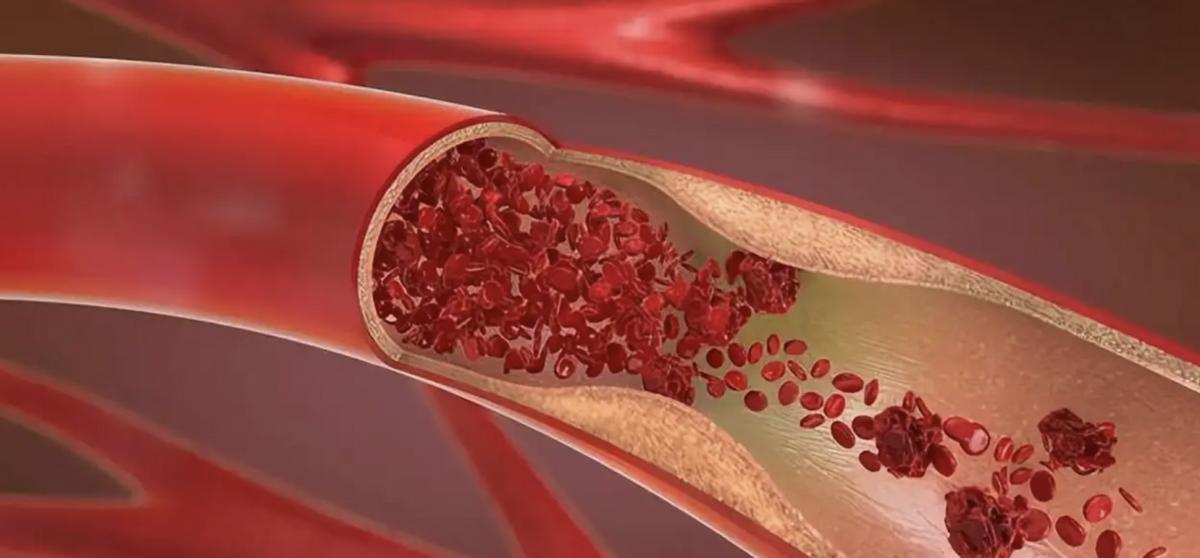 比“熊猫血”还稀有的救命血,世界上最罕见的血熊猫血