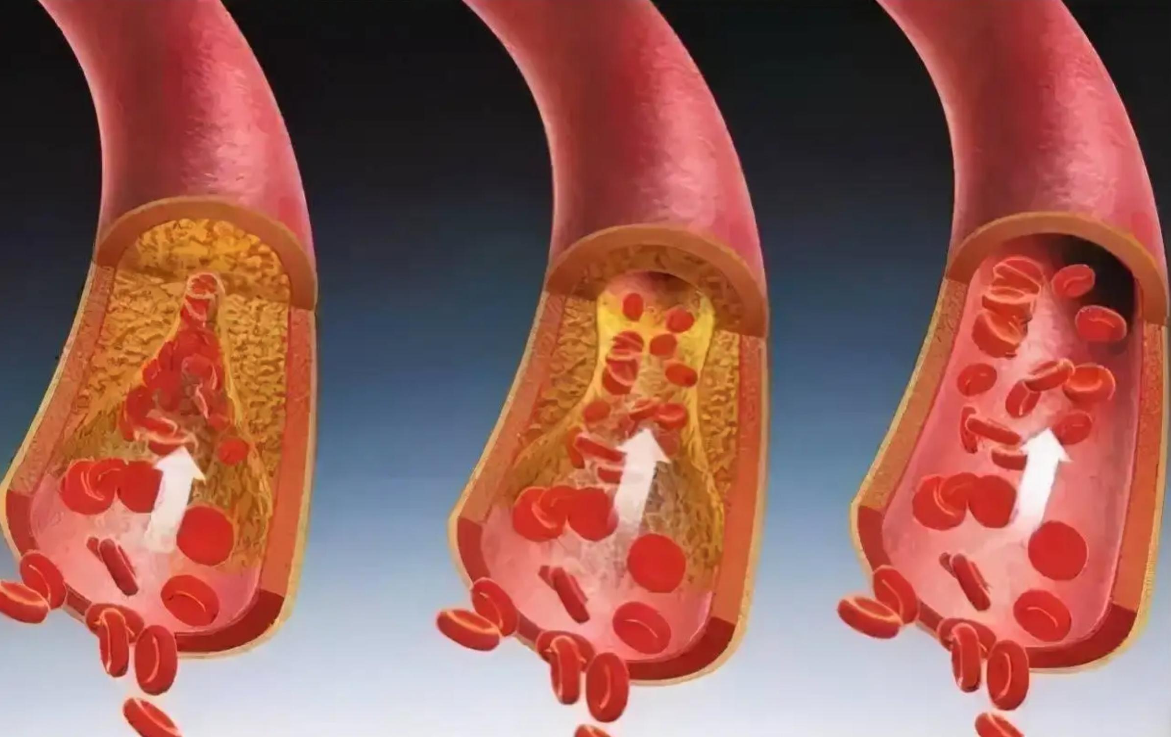 患上糖尿病后，“性功能”越来越差是怎么回事？