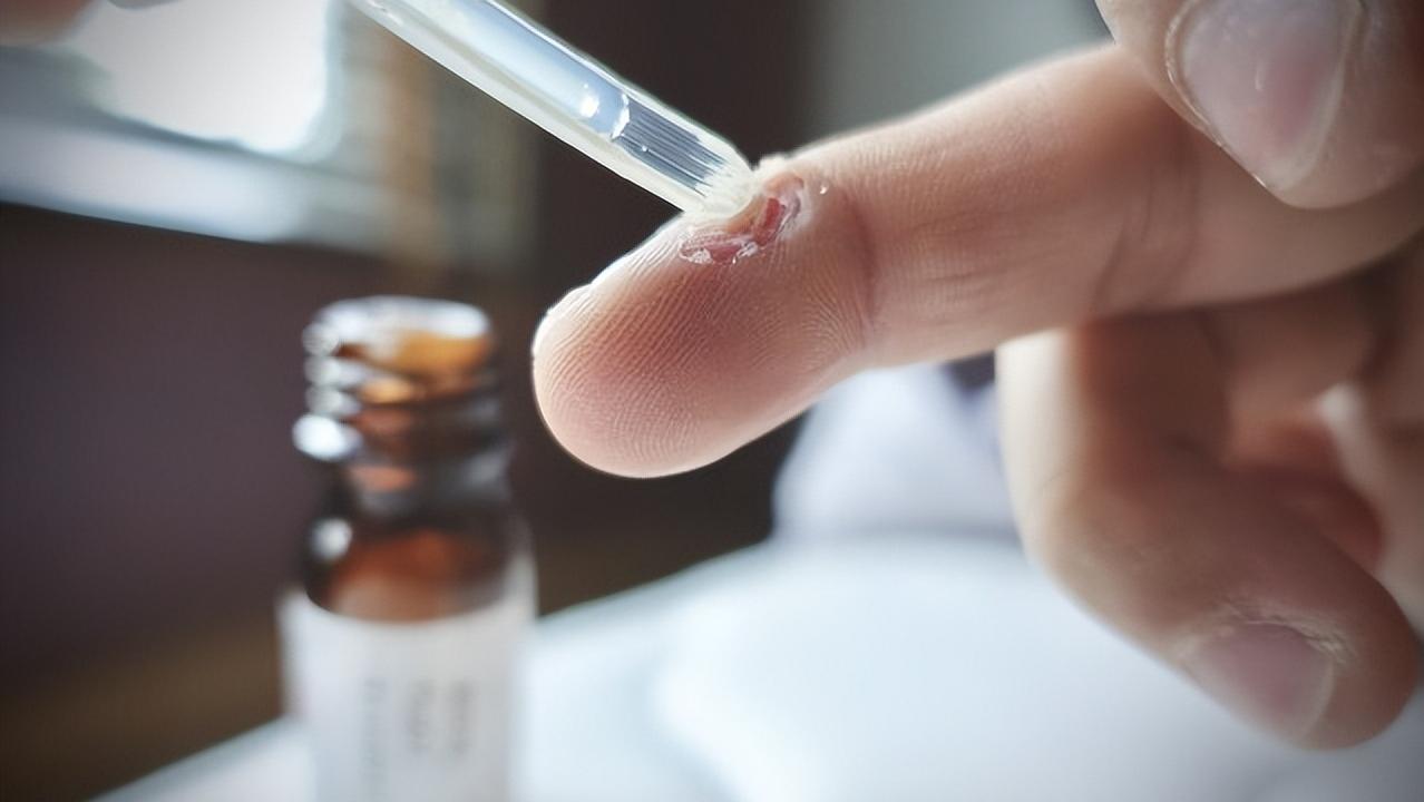 水杨酸适合爆痘的人使用吗,水杨酸抗痘