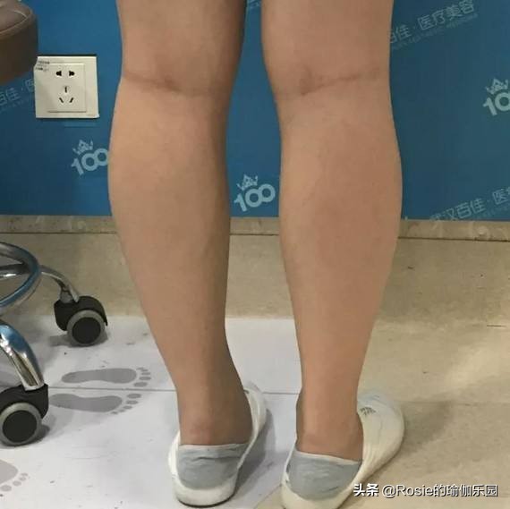 大腿小腿瘦的最快动作,如何瘦大腿和小腿动作图解