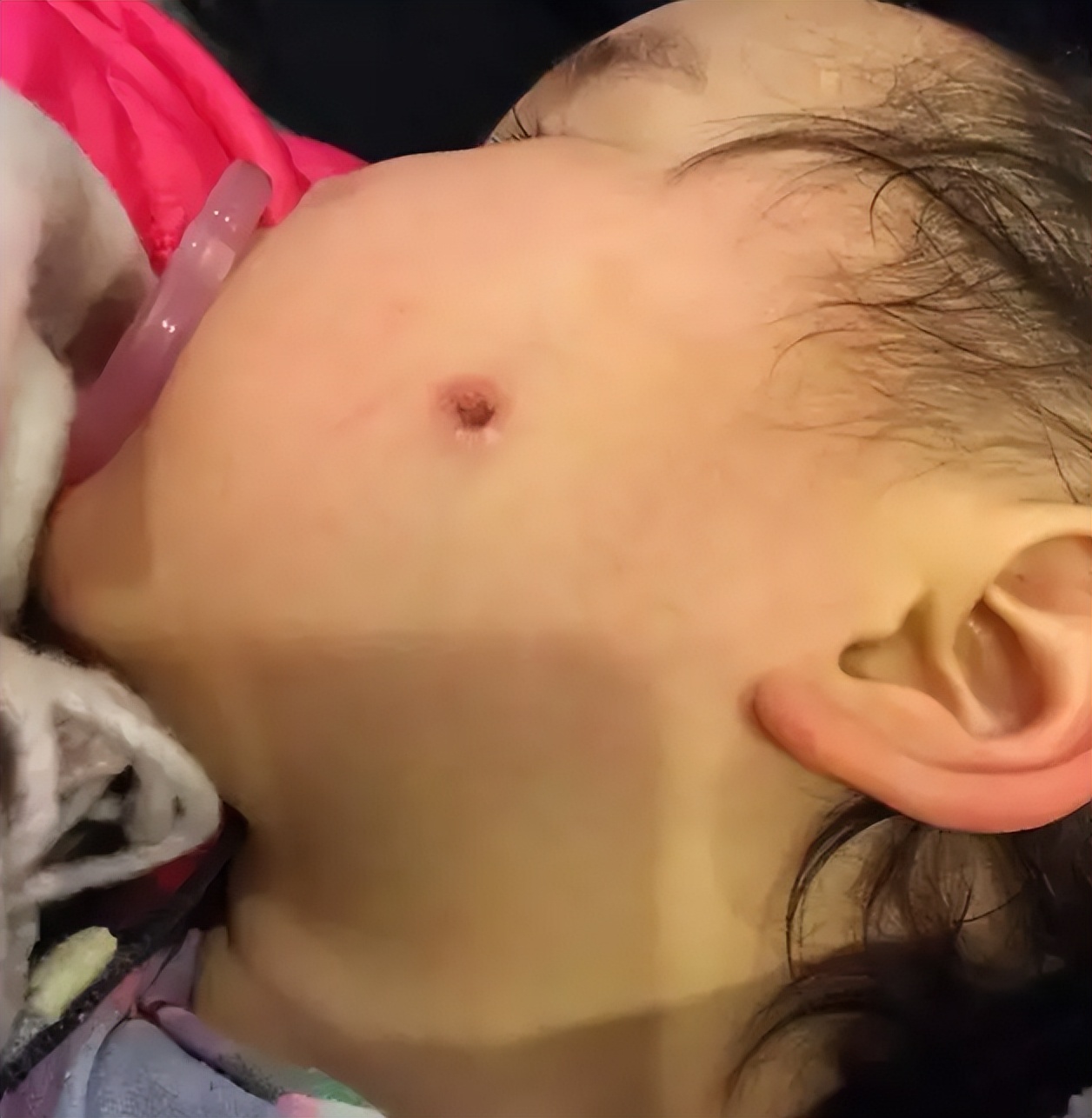 宝宝夏天很惹蚊子,宝宝被蚊子困扰