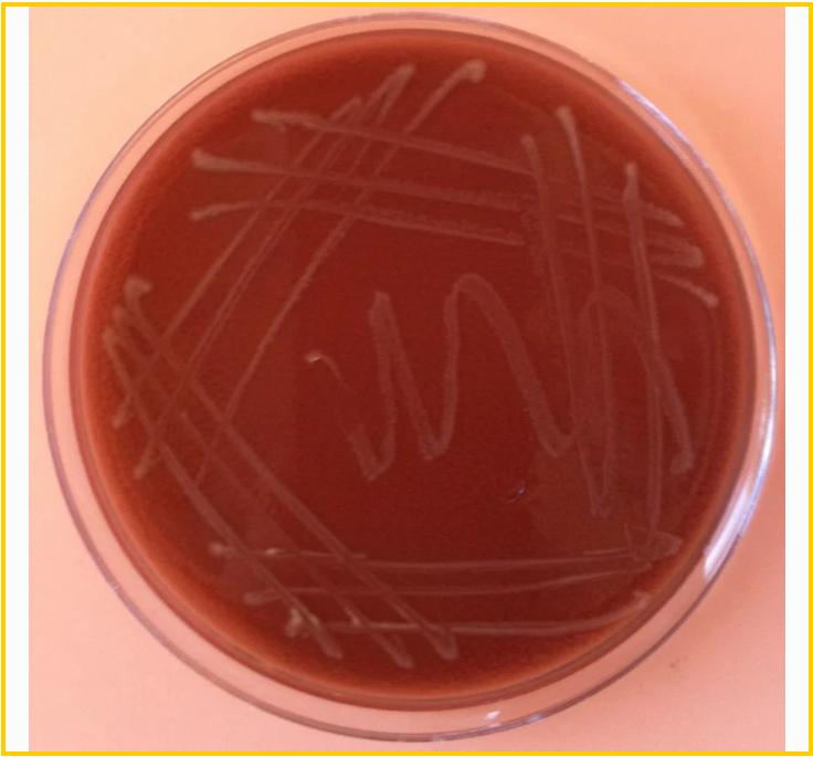 病原菌属——嗜血杆菌（Haemophilus），进入肠道也要注意