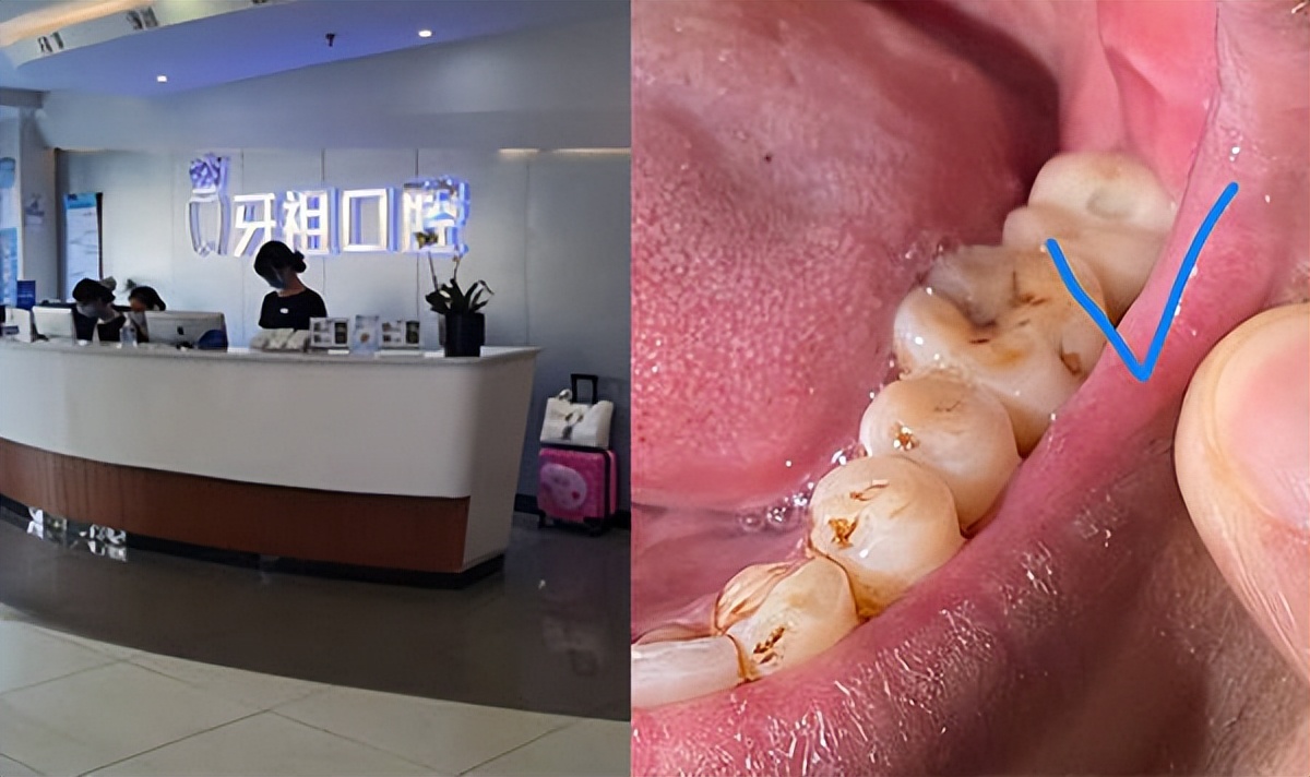 黑牙医去哪里投诉,黑牙医把牙磨坏