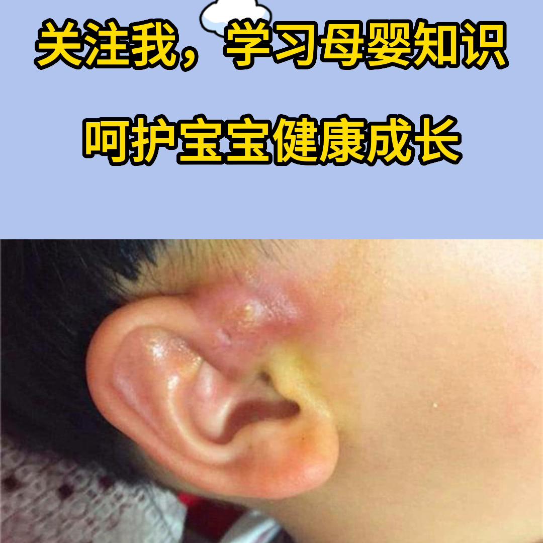 宝宝耳朵发炎的症状,宝宝耳部感染症状