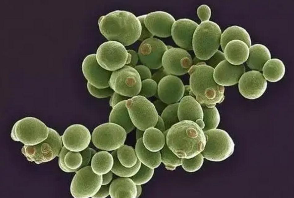 内裤上有分泌物什么原因,为什么内裤总是有分泌物