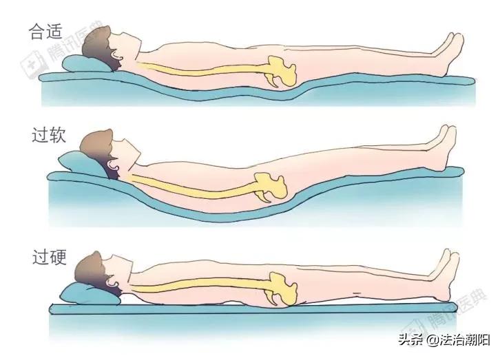 睡硬板床不能治腰椎间盘突出！3个小误会一次说清