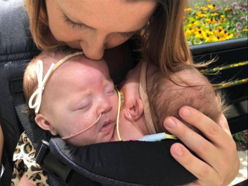 双头人连体姐妹怎样结婚,连体双头姐妹怎么结婚