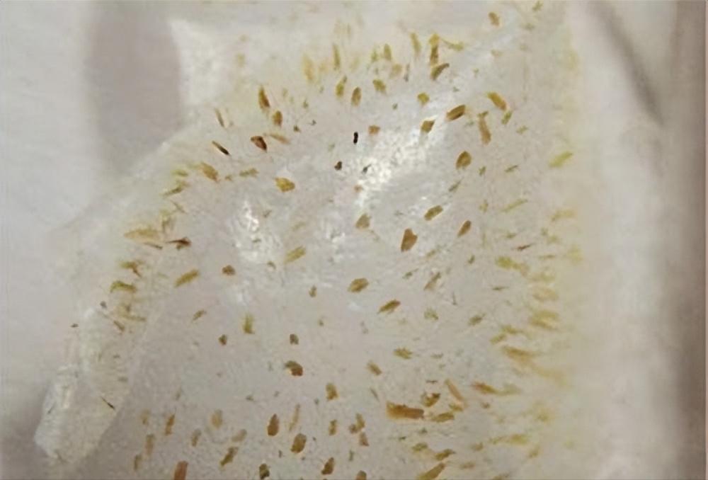 去鼻子上的黑头最好的方法,去鼻子上黑头的有效方法