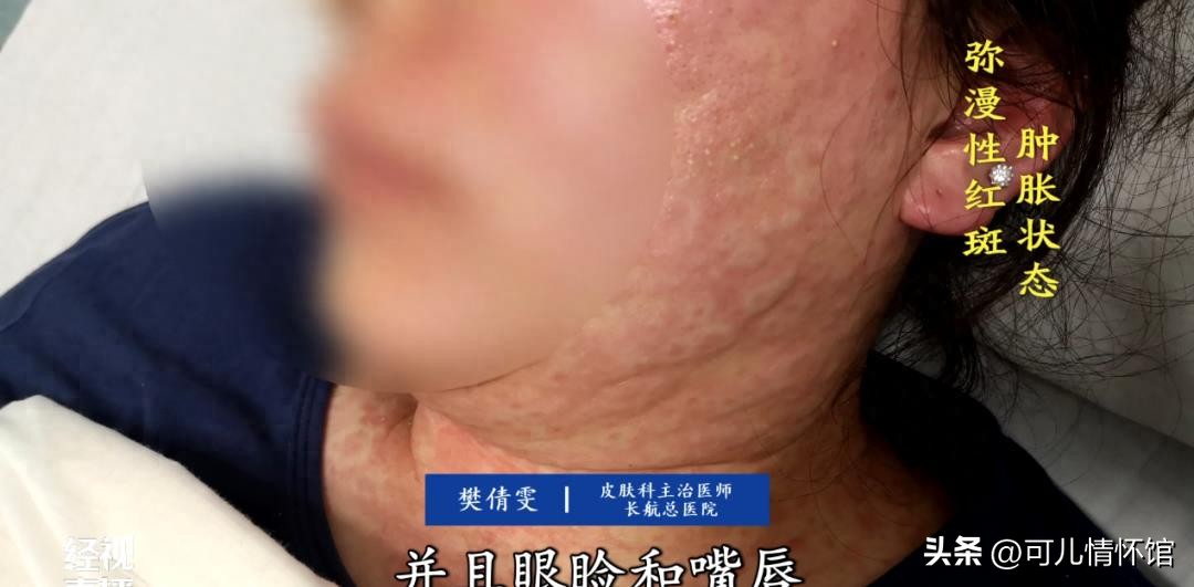 警惕女子20分钟连喝4瓶水身亡,武汉女子喝水喝“毁容”