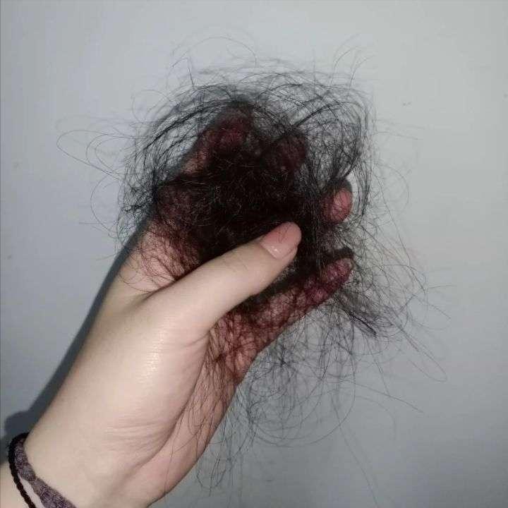 防脱洗发水好文,防脱洗发水用一次有没有事