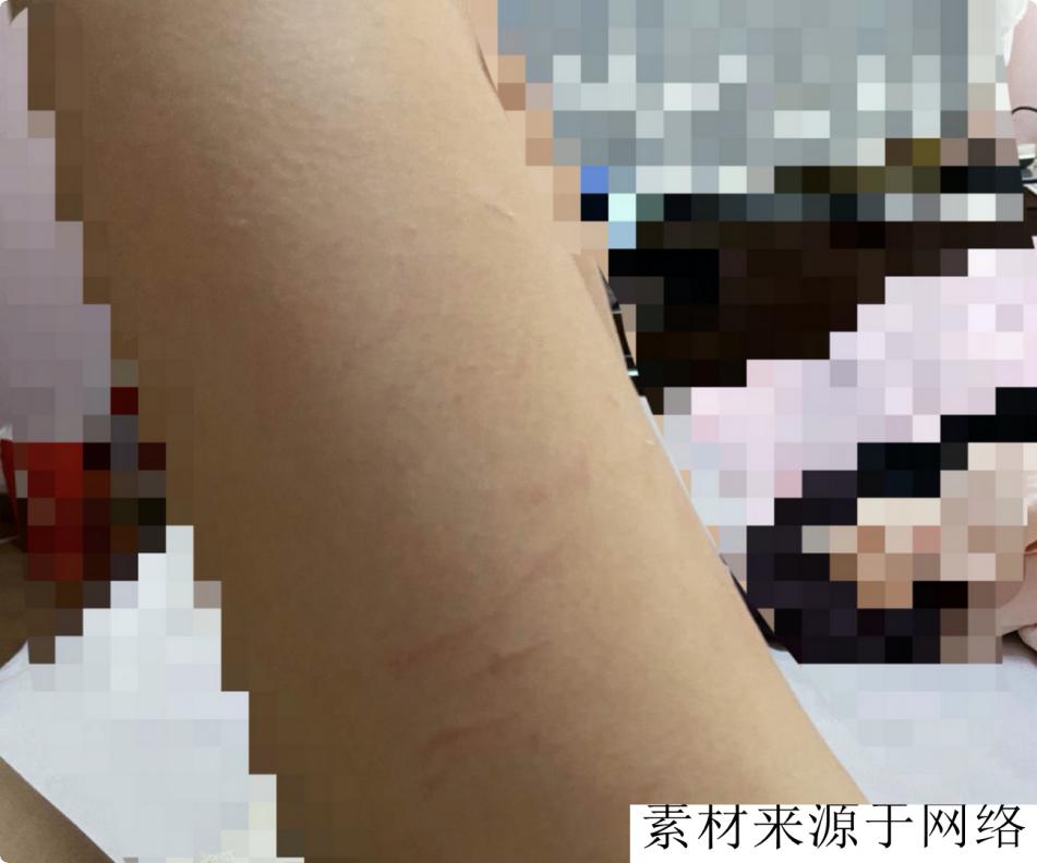 故事：性病耻感：感染性病后，讳疾忌医的年轻患者们