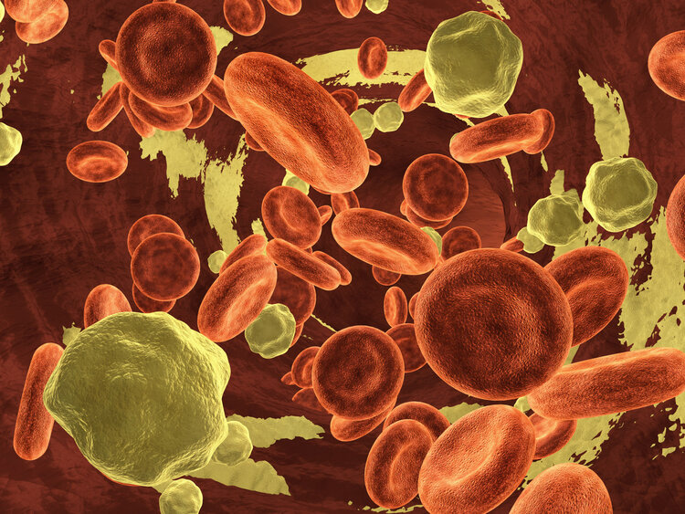 血脂和胆固醇偏高能怎么预防,胆固醇血脂偏高怎么降下来