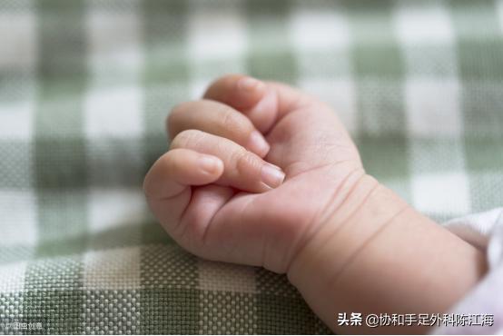 儿童天生手指并指畸形能治好吗,孩子拇指畸形