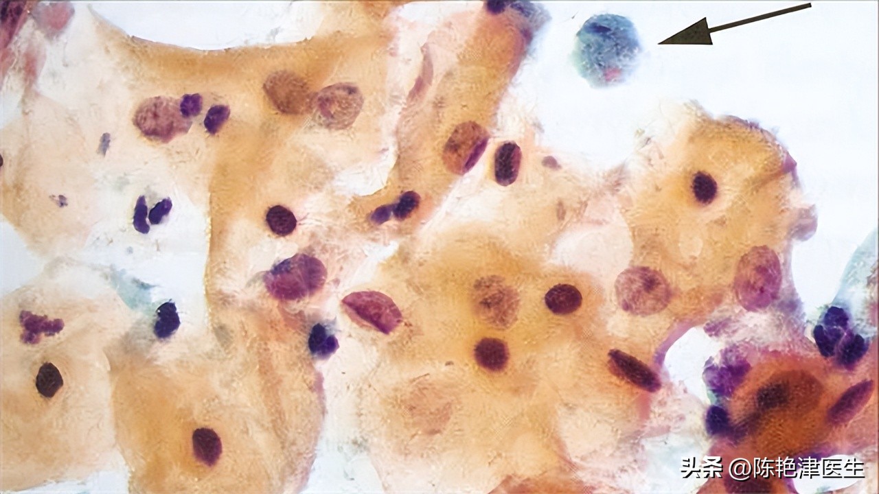 甲硝唑一瓶250ml多少毫克,甲硝唑最少一瓶是多少片