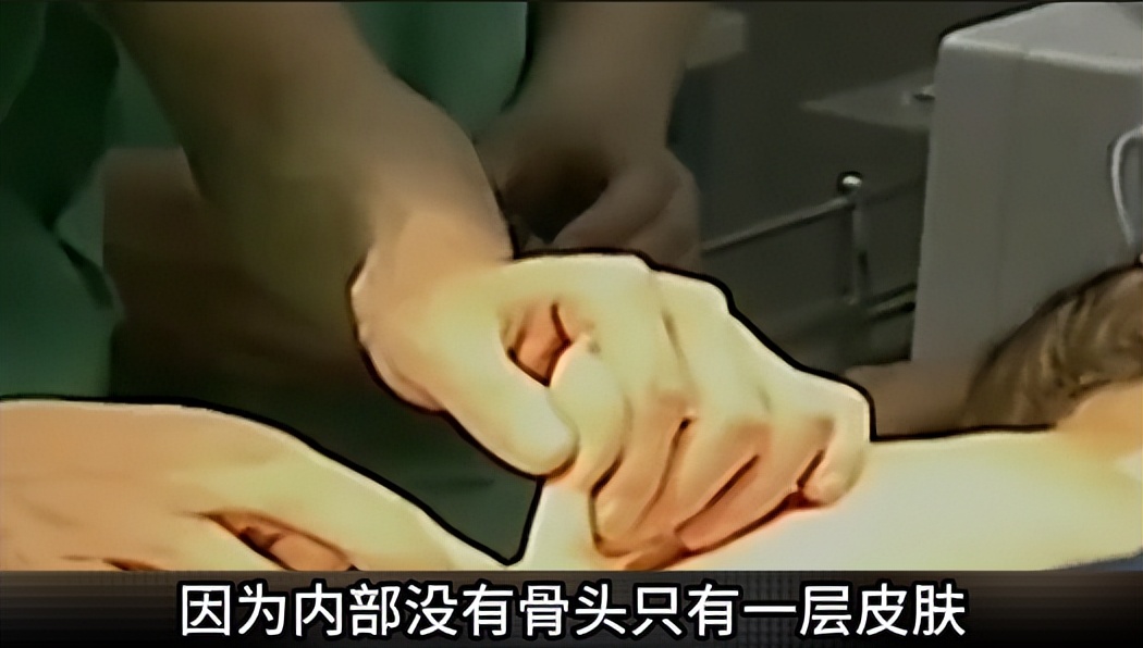 母猴子怀孕生下三胞胎,孕妇生下来的猴子