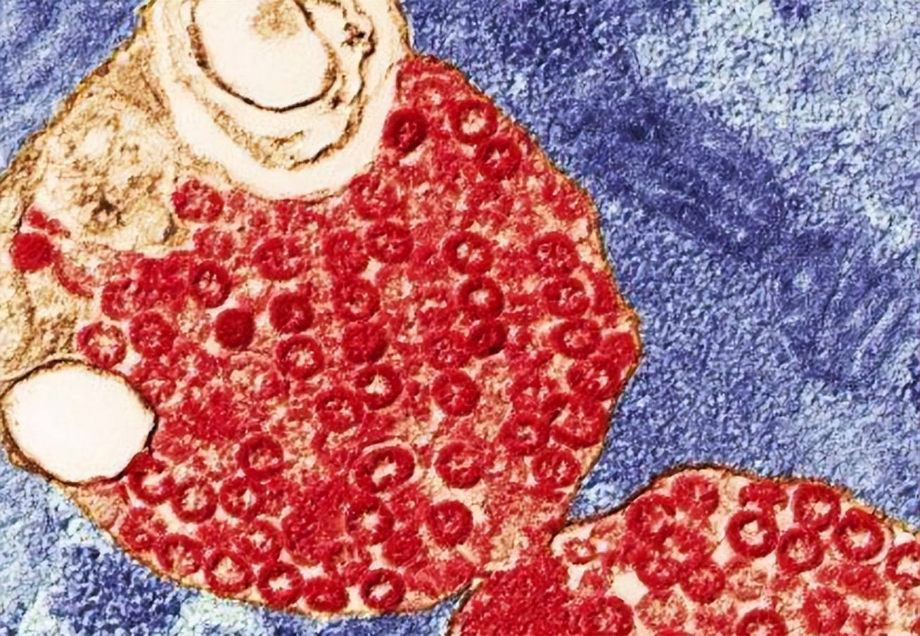 世界上最致命的病毒九种,细菌和病毒哪个更致命