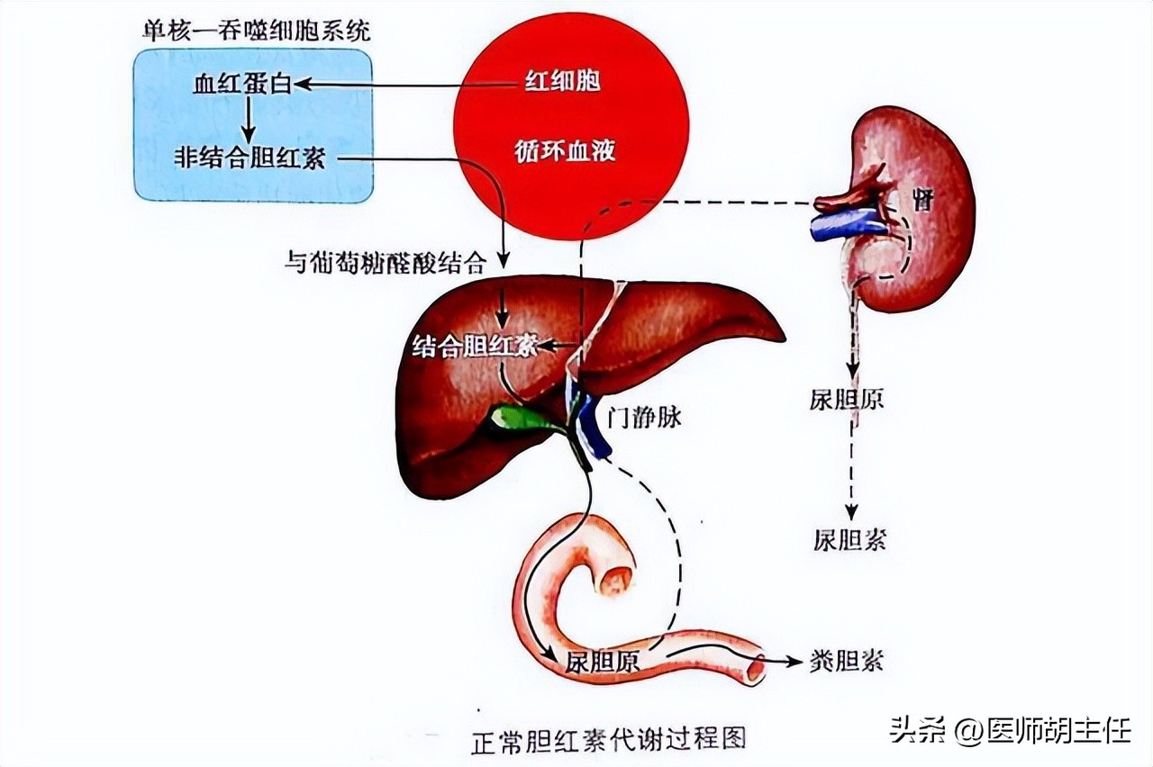 肝病胆红素偏高怎么才能降下来,体检胆红素偏高怎么快速降低