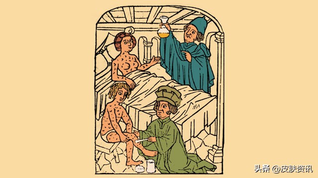 梅毒的起源和历史,历史上梅毒的起源