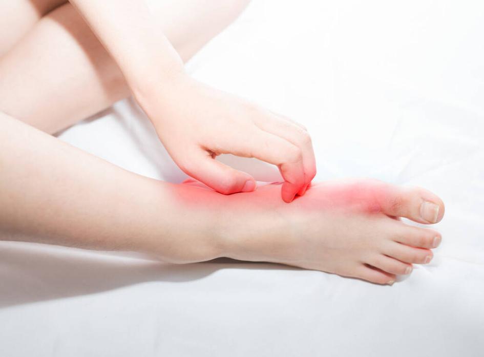 梅毒脚和脚气有什么区别,梅毒脚气是单脚有还是双脚有