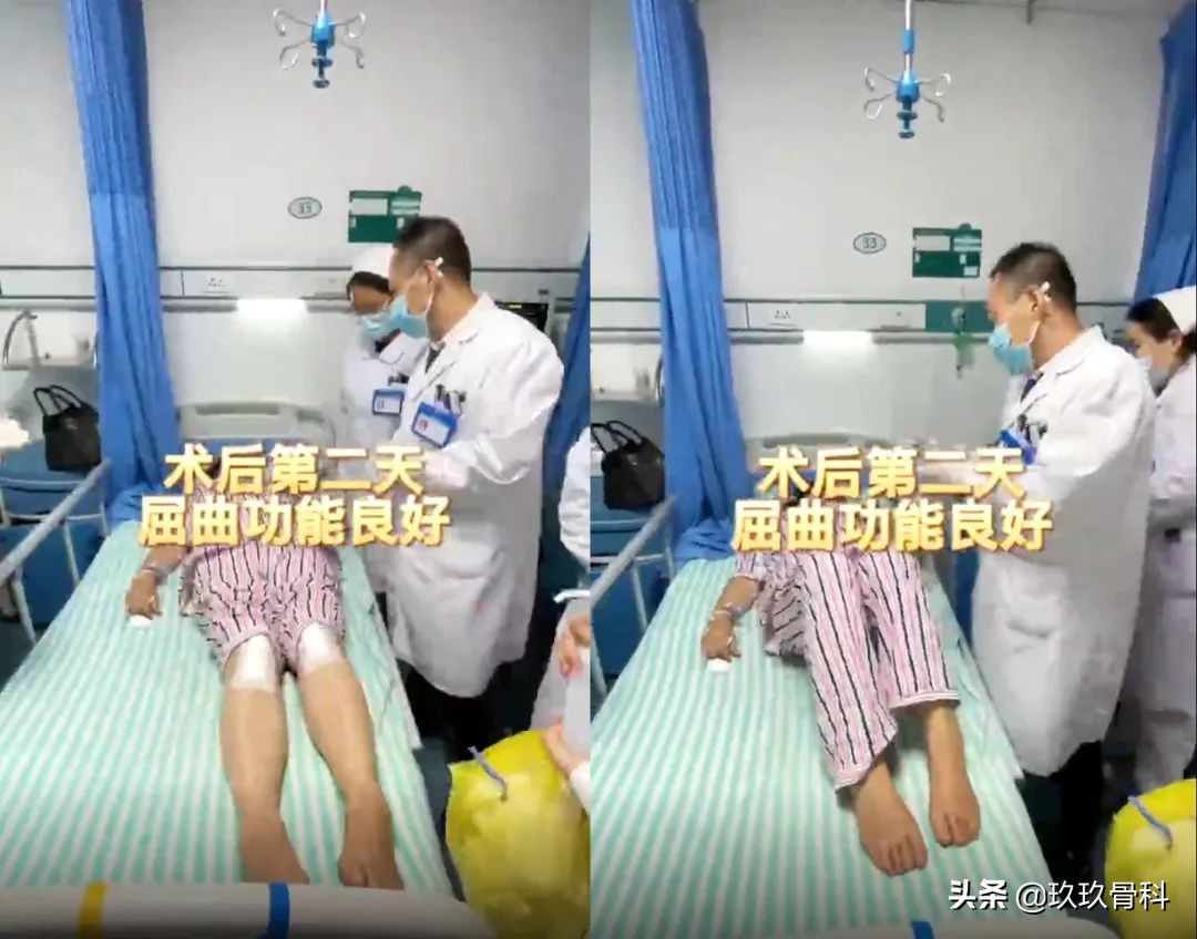 贵阳东方骨科医院膝关节置换,骨科单髁置换手术