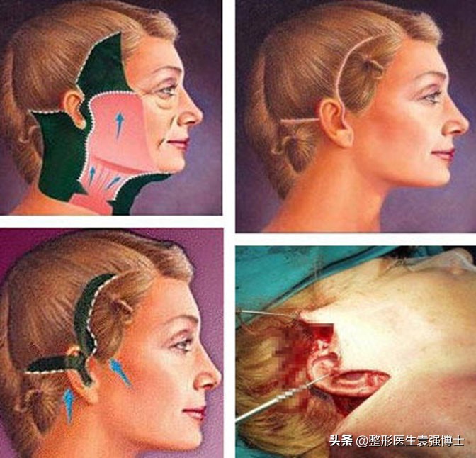 35岁了怎么改善松弛,35岁脸部紧致的10个训练