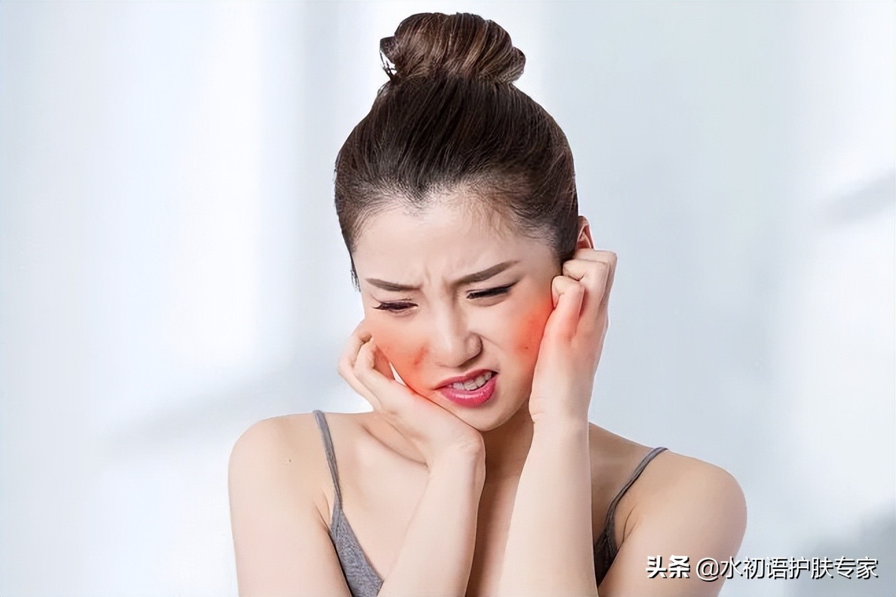 夏天容易长痘出油怎么办,夏日炎炎脸上开始爆痘怎么办