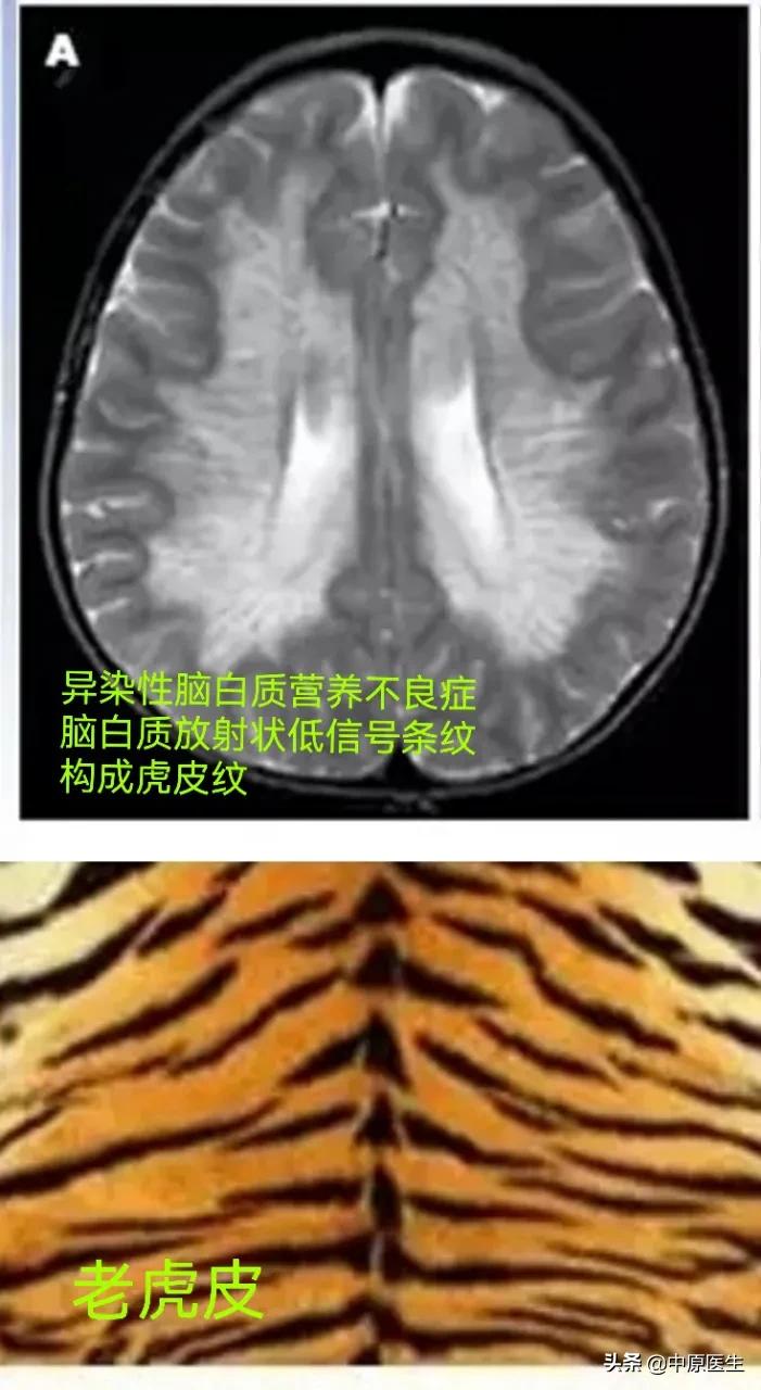 老虎的体质有多强,老虎与人类关系好吗