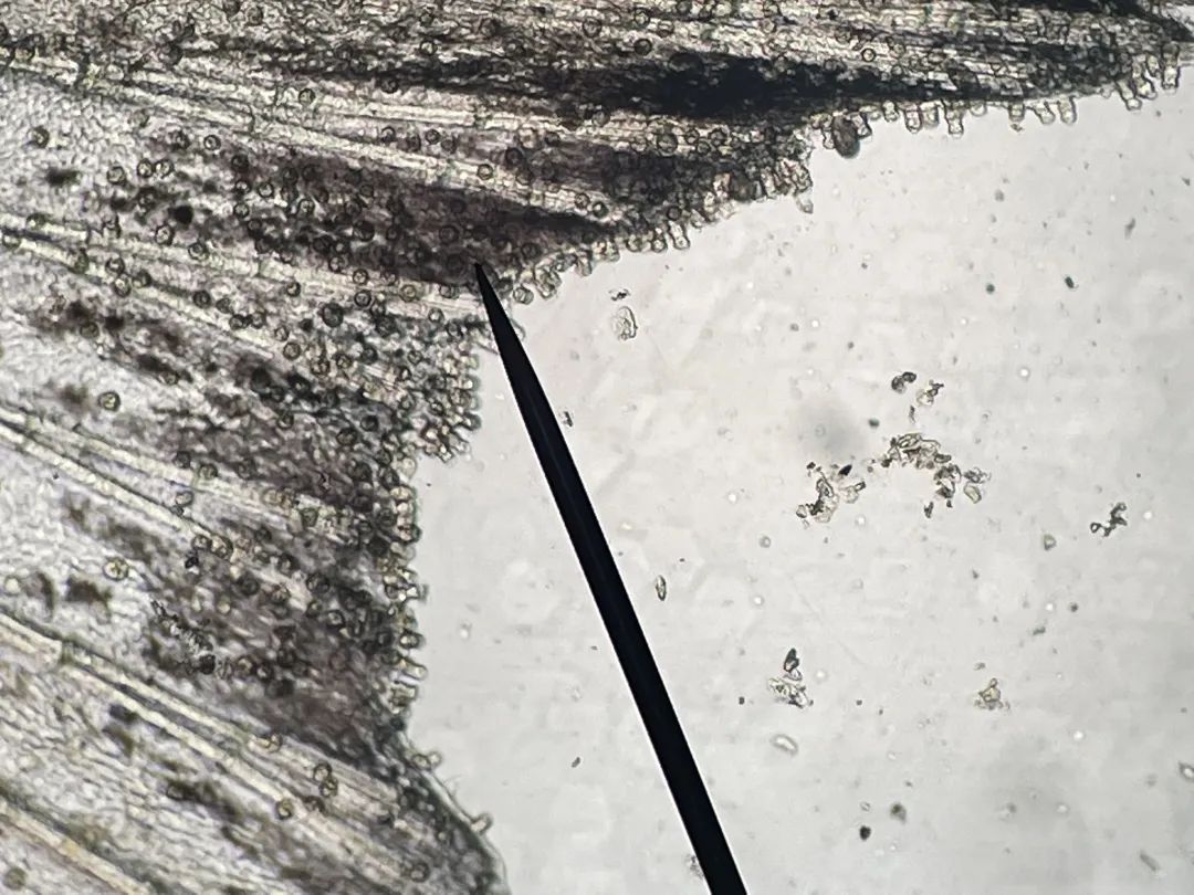 杯体虫在鮰鱼上面很常见,科学养殖塘鲺鱼苗