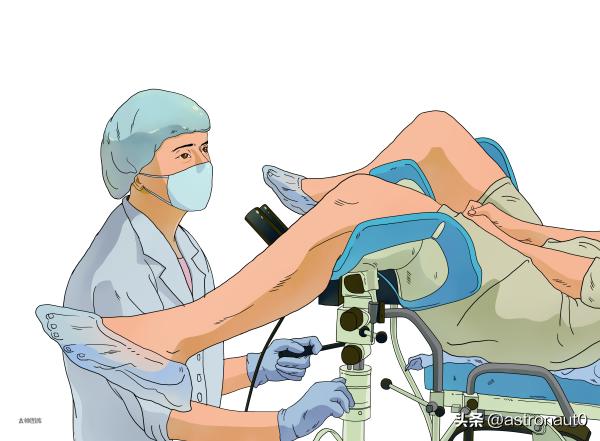 有盆腔积液，就是得了盆腔炎吗？到底要不要治？