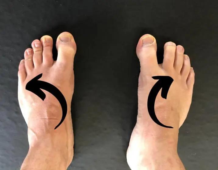 深蹲膝盖内收该如何矫正,深蹲膝盖内扣很疼该怎么改正