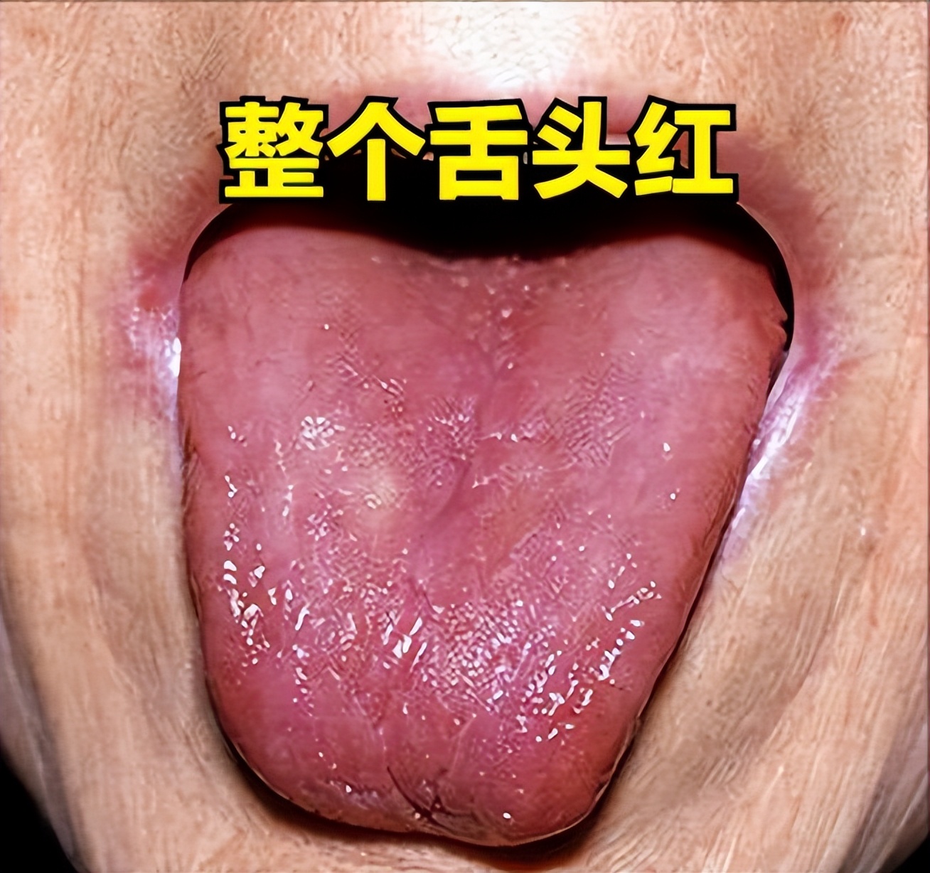 失眠舌头发涩是什么征兆,经常失眠舌苔白