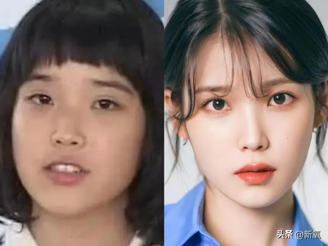 改一点赢很大？她整完鼻子直接美成断代神颜…