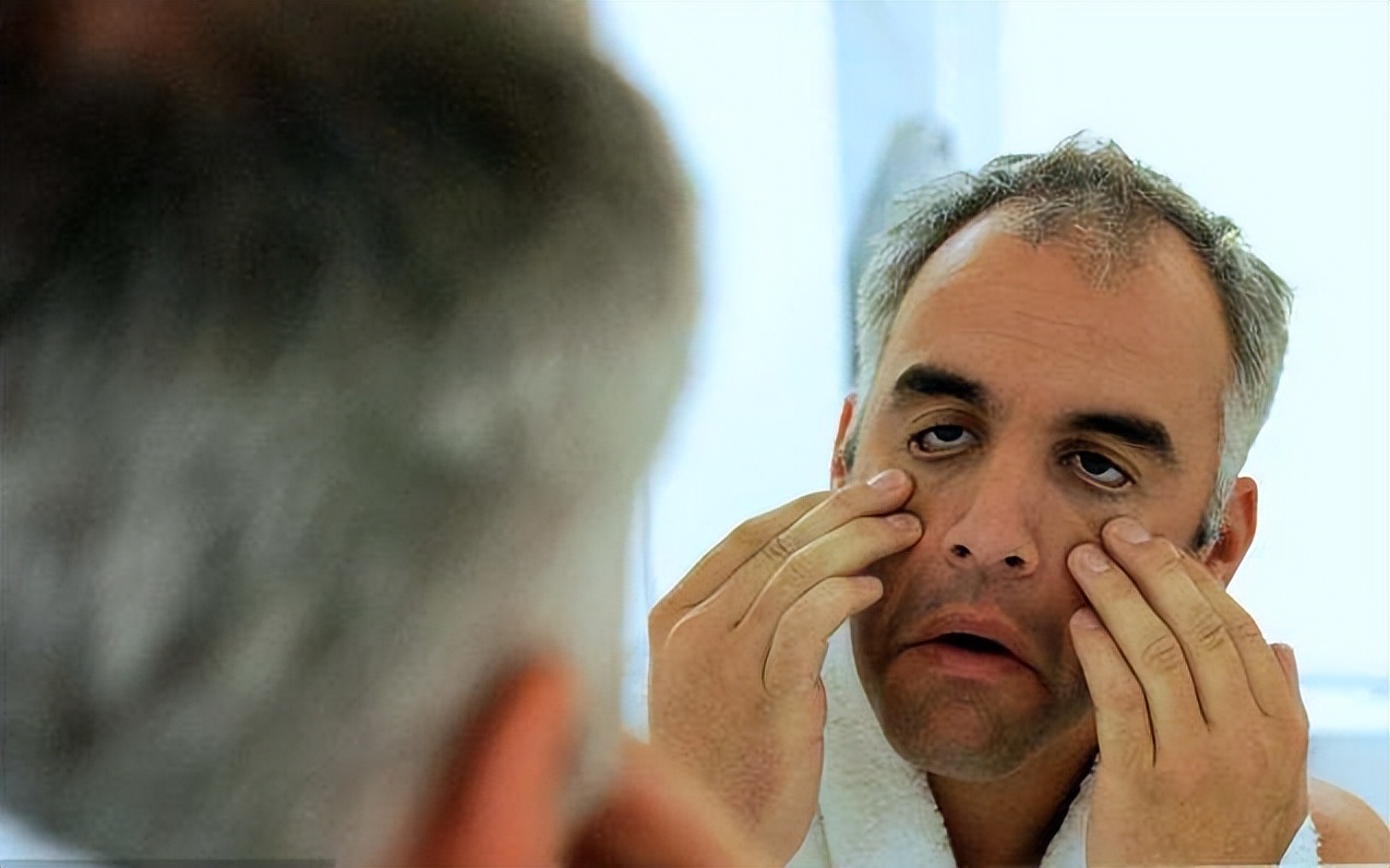 什么迹象可以看出男人衰老了,男人进入衰老期的四大表现