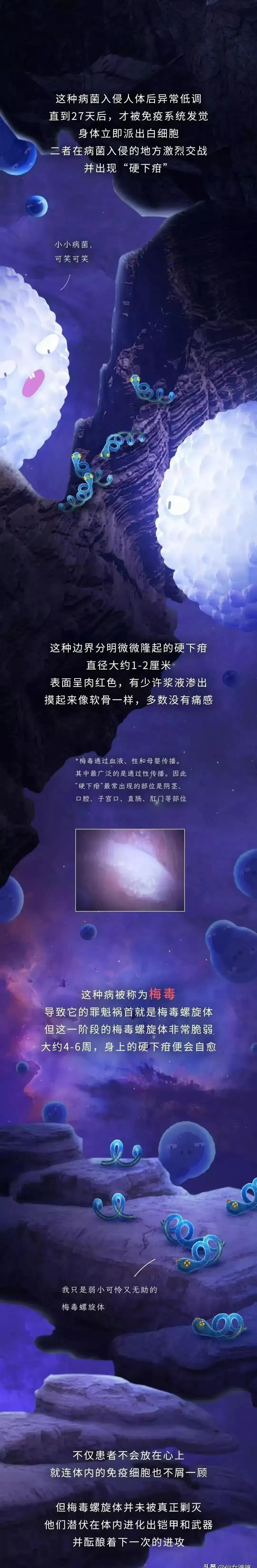 感染梅毒是什么症状,感染梅毒是有什么症状