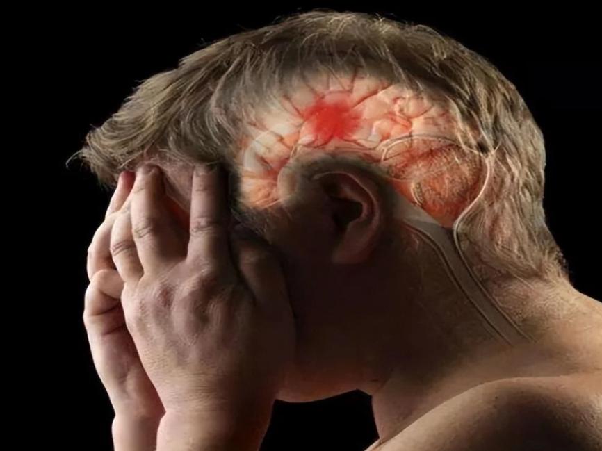 浅谈脑出血发病原因,脑出血好发于寒冷季节