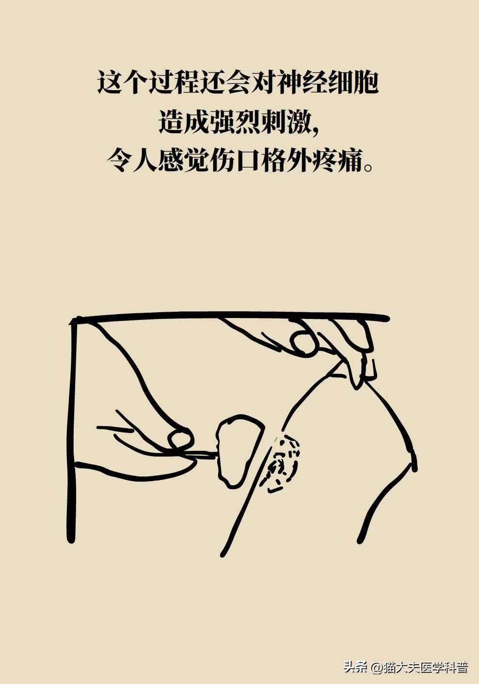 伤口上撒盐是为了什么,伤口撒盐是正确的吗