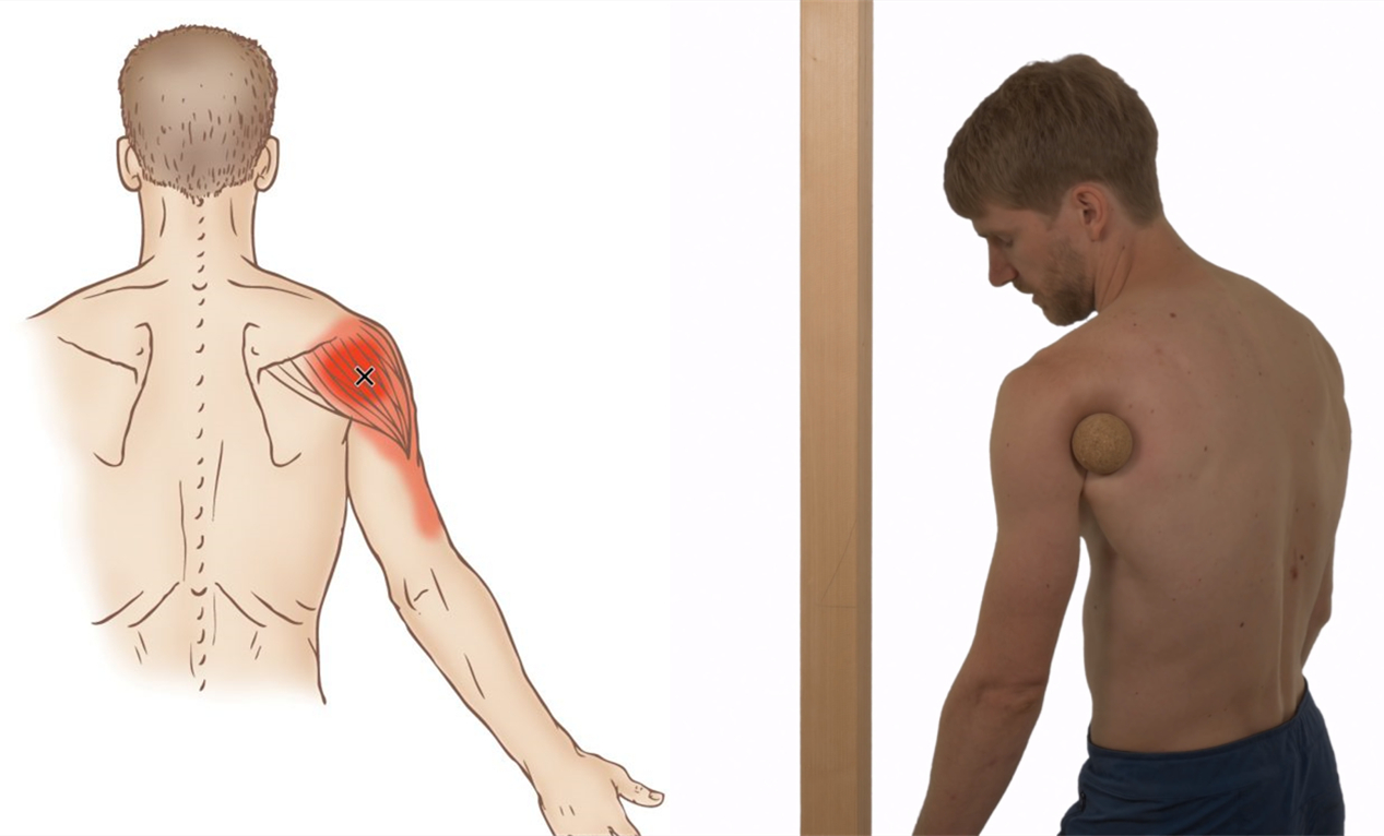 三角肌的松解方法,三角肌手法松解