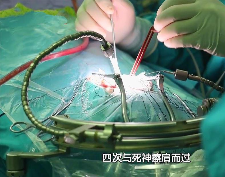 8岁儿童脑部肿瘤的症状10大前兆,儿童脑肿瘤手术得多长时间