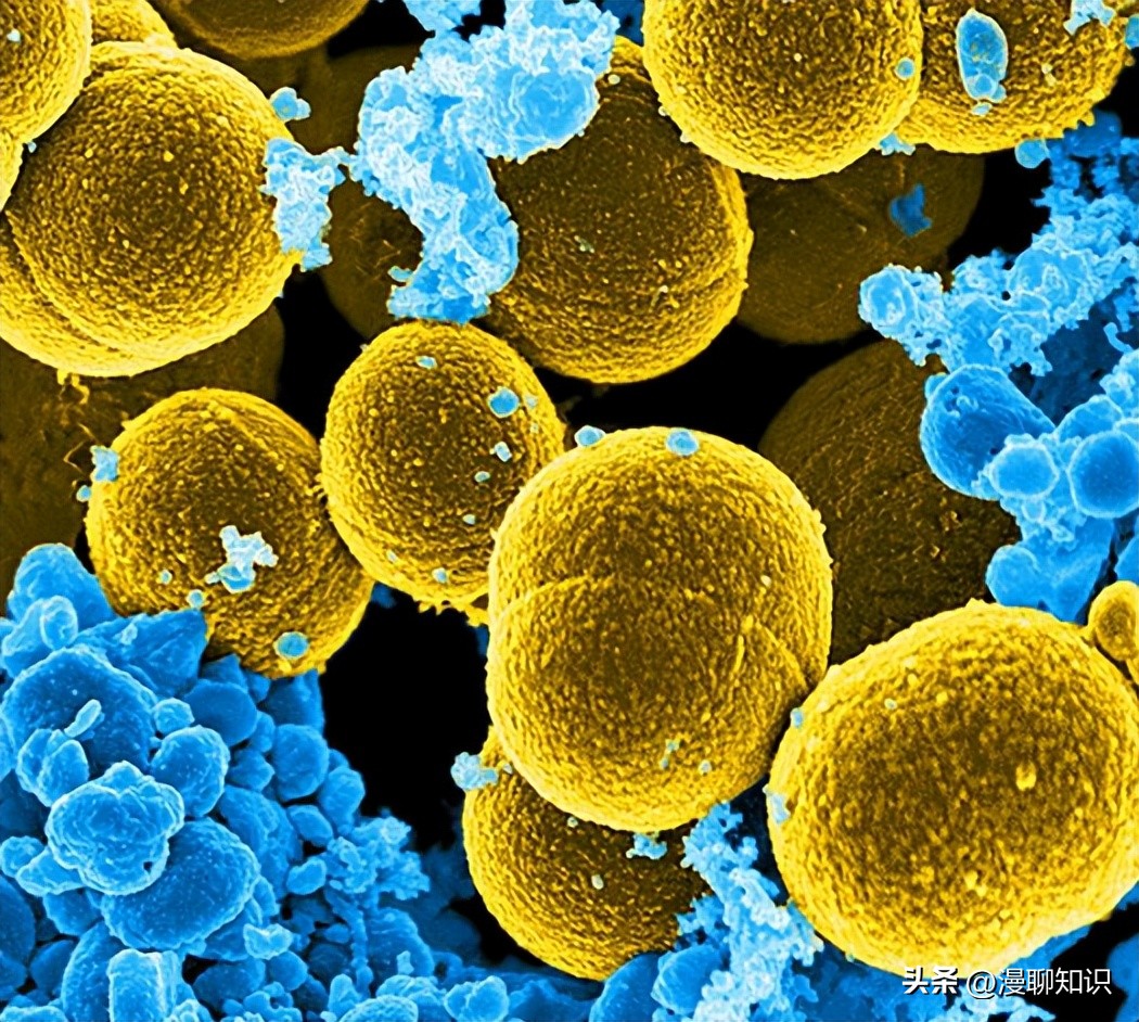 牦牛是高山地区牛的独特品种，肉质鲜嫩，但却饱受葡萄球菌的侵害